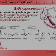 Экг Под Силу Каждому 3