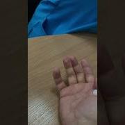 Сдаю Кровь Из Пальца