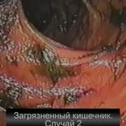 Лекции Доктора Хироми Шинья