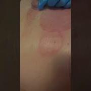 Приколы Про Баночный Массаж