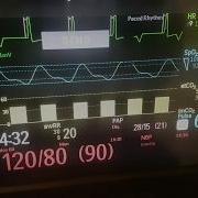Philips Mx400 Demo