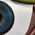 LASIK Eye Surgery 3D Animation