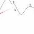 Jugular Venous Pressure Waveform