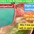 Clean Colon From Stuck Old Poop Ibs Colon Cleaning Constipation