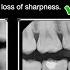 Radiographic Sharpness Resolution Human Eye Resolution Project 1