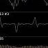 OUTDATED V2 Undertale OST 051 Another Medium Oscilloscope View