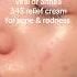 Using Dr Althea 345 Relief Cream For Acne Redness