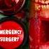 Emergency FruitSurgery The Button Is Back Giant Glizzy Gives Birth FoodSurgery DiscountDentist