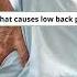 Low Back Pain 7 Common Causes Merck Manuals Consumer Version