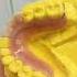 Rashid Dental Clinic Denture Extraction Crown Scaling Polishing Braces Rct Filling
