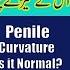 Penile Curvature Nafs Ka Terhapan Aur Isko Seedha Krne Ka Tareeqa Dr Fartash Sarwar