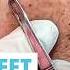 Sweet Sounds Sweet Pops Just Blackheads