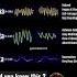 The Mind Frequencies Brainwaves Humanmind Meditation Alphawaves Betawaves
