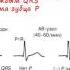 Урок 3 Видеокурс ЭКГ под силу каждому