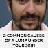 2 Common Causes Of A Lump Under Your Skin