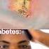 Diabetes Speed Run Tututu Meme Shorts