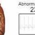 Normal Vs Accelerated Heart Rate