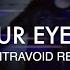 ULTRA SUNN Keep Your Eyes Peeled Kontravoid Remix