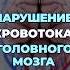 Простой способ улучшения кровотока головного мозга здоровье шишонин