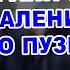 КАКИЕ ОГРАНИЧЕНИЯ ПОСЛЕ УДАЛЕНИЯ ЖЕЛЧНОГО ПУЗЫРЯ ТОП 5 ВОПРОС ОТ МОИХ ПАЦИЕНТОВ