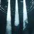 Swedish House Mafia It Gets Better David Guetta Zedd Extended Mix