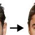 What S Up With Zac Efron S Face Expert Plastic Surgeon Weighs In