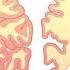 5 Habits That May Reduce Your Risk For Developing Alzheimer S