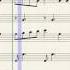 Echo By Gumi Arranged For String Orchestra