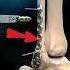 Ankle Joint Fibula Bone Fracture Surgery 3D Animation Shorts