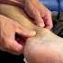 If You Have Pain In Your Achilles Tendon This Video Is For You Shorts