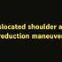 Dislocated Shoulder And Reduction Maneuver