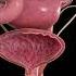 Understanding Cystitis What You Should Know Anatomy