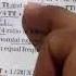GENETICS IMPORTANT POINTS AIIMS