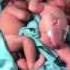 Maternal Infant Care In The Dominican Republic A Physicans For Peace Mission 2013