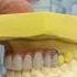 Rashid Dental Clinic Denture Extraction Crown Scaling Polishing Bleaching Rct