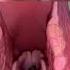 Live View Of The Vocal Cords Anatomy Medical Funfacts