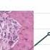 Cellular Basis Of Orthodontic Tooth Movement And Speeding Tooth Movement