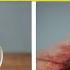 The 1 Herbal Tea That Actually Kills CANCER Why Is This Being Hidden