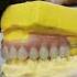 Rashid Dental Clinic Denture Extraction Compositefilling Scaling Polishing Braces Rct Crown