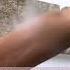 How Did I Cover My Scars Varicose Veins Age Spots Stretch Marks Birthmarks Tattoos Beauty