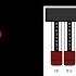 Hammond Organ Tonewheels And Drawbars A Brief Overview