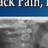 Can Degenerative Discs Heal Normal Again Neck Pain Back Pain Pinched Nerve Dr Mandell