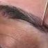 Eyebrow Transplant Eyebrowtutorial