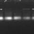 How To Label Gel Electrophoresis Pictures For Thesis And Research Articles