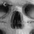 Dark Minimal Techno Trip Live Radio 24 7