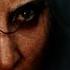 Lady Gaga Disease Official Music Video TV Version