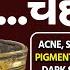 क तन भ प र न ACNE SCARS PIGMENTATION DARK CIRCLE ह ग जड स खत म 100 ग ल आय ग Skin Care