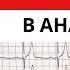 3 простых шага в анализе ЭКГ Понятный алгоритм анализа ЭКГ