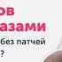 9 причин СИНЯКОВ ПОД ГЛАЗАМИ справимся без патчей и филлеров