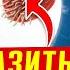 ГЛИСТЫ паразиты НЕ помогут ЗОЖ травы кора осины чеснок Часть 2 Ленточные черви